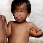 Little Manny